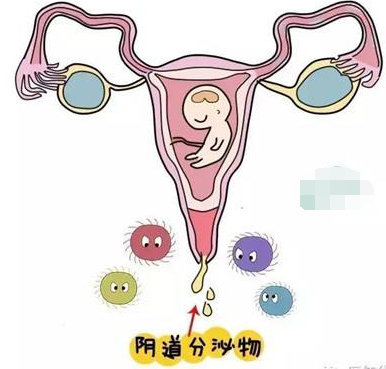 阴道分泌物香蕉视频下载安装的一般性状检查类型