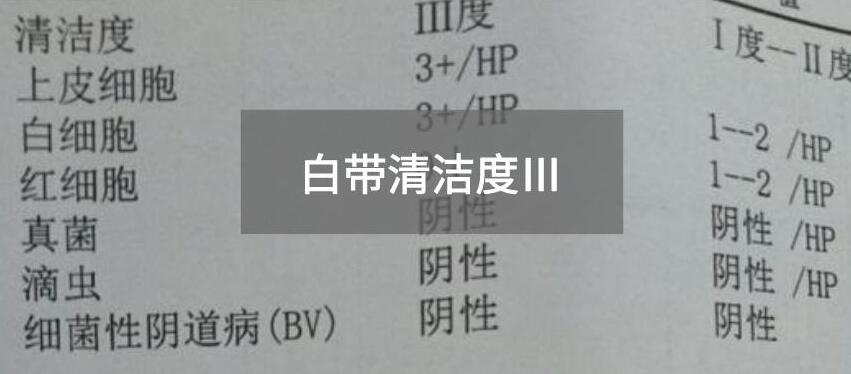 今天快讯！全自动白带香蕉视频成年人生产厂家91香蕉下载安装为您官方解释白带清洁度3的意思