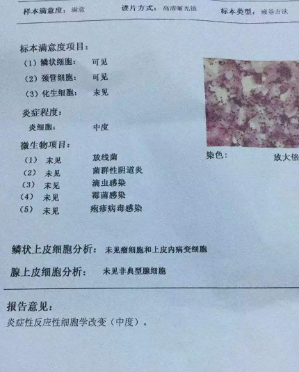 阴道分泌物香蕉视频下载安装厂家教你查看阴道分泌物检测报告