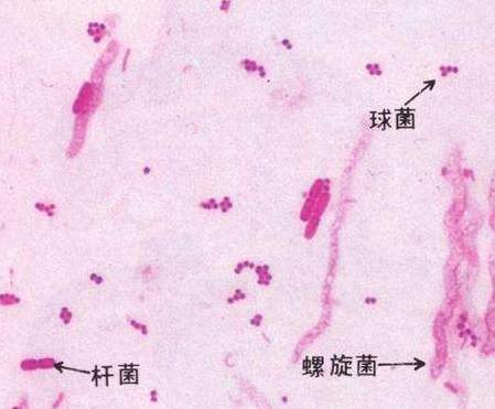 妇科白带香蕉视频下载安装厂家分析白带线索细胞阳性的意义