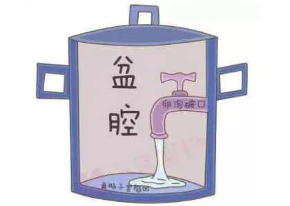 盆腔积液是怎么回事？白带香蕉视频成年人厂家提醒早了解早预防