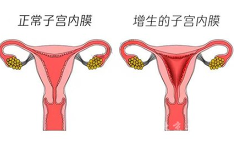 白带常规香蕉视频下载安装厂家解读子宫内膜增生是什么原因引起的