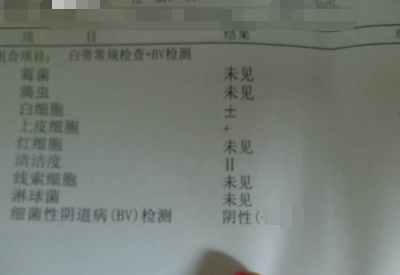 全自动白带香蕉视频成年人分享如何看懂白带常规检测报告单